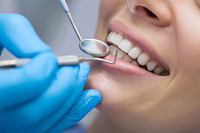 Bayonne Dental Checkups